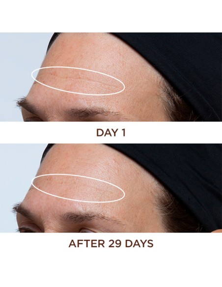 Cold Plasma Plus+ Face