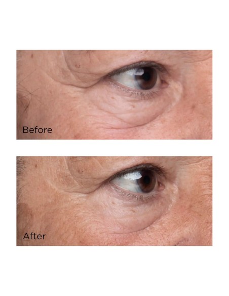 High Potency Growth Factor Firming & Lifting Eye Serum