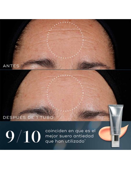 Crystal Retinal 6