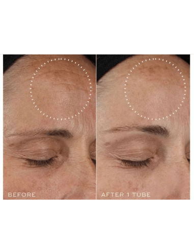 Cofre Retinal Recharge