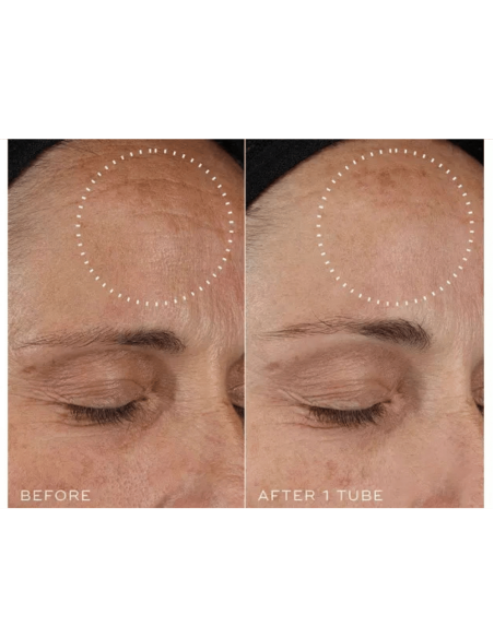 Cofre Retinal Recharge